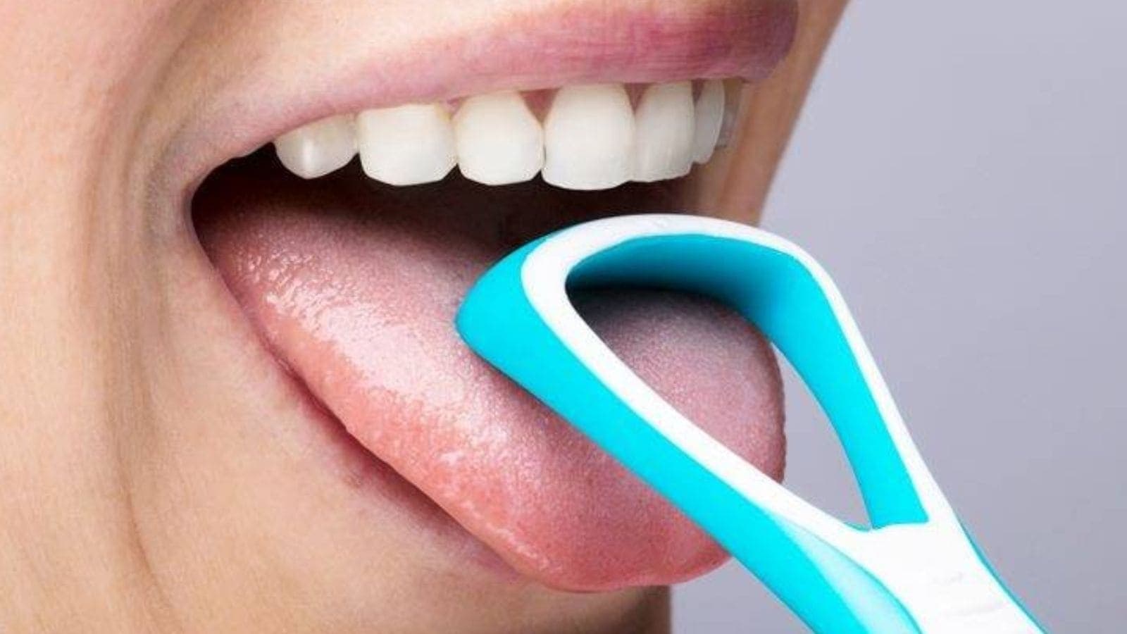 A non-smoker, 23-year-old thought her tongue ulcer to be an accidental bite: It was oral cancer