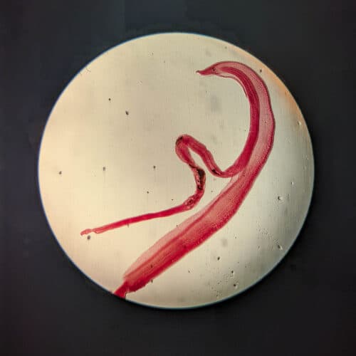 Woman's brain worm infection confirmed after eggs grow tails in lab test