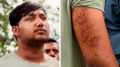 India's 'cockroach' protesters have wounds consistent with pellet-gun fire, say experts