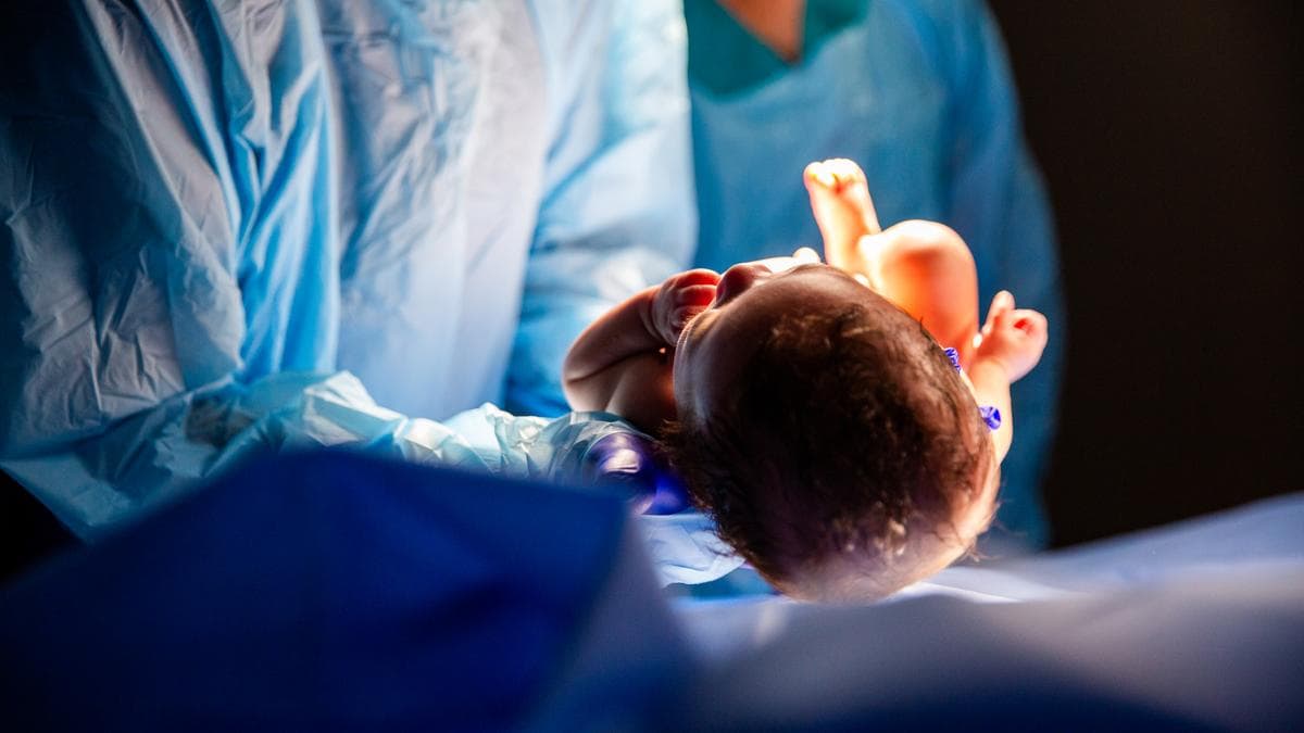 Nine in ten: Why Jammu and Kashmir’s private hospitals have India’s highest C-Section rate