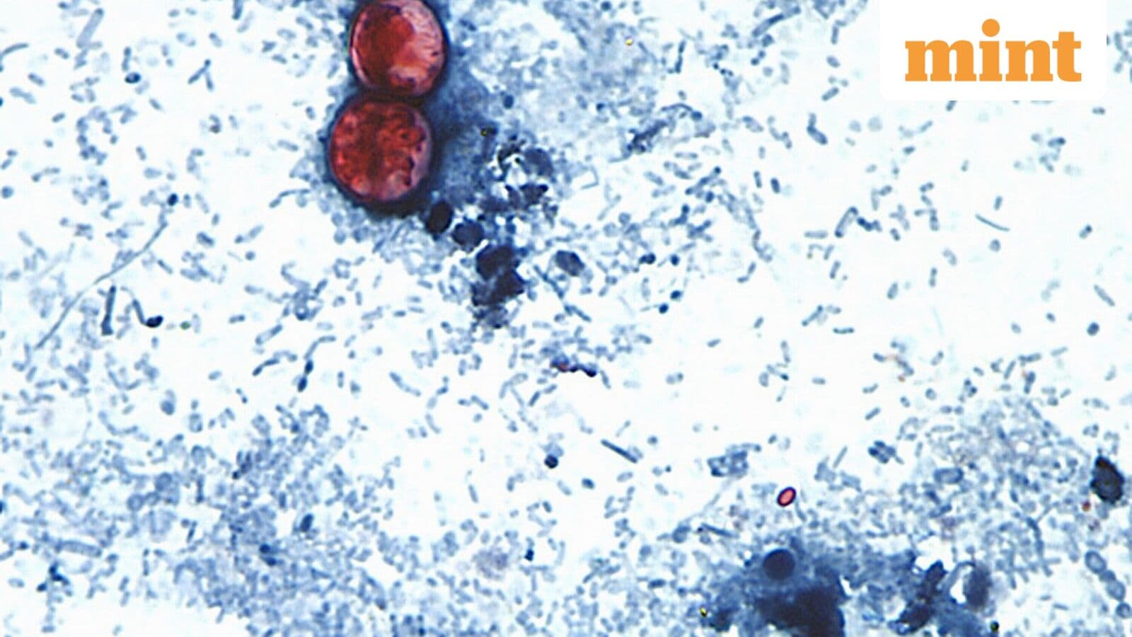 Michigan confirms first Cyclospora deaths in US amid outbreak that has sickened over 20,000
